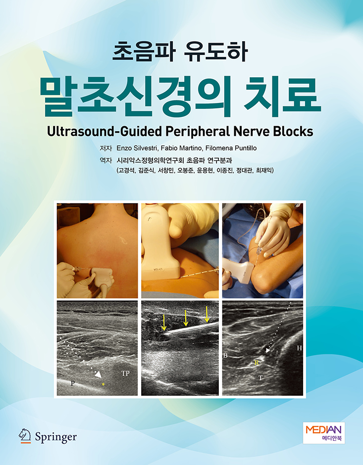 초음파유도하 말초신경의 치료