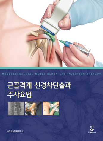 근골격계 신경차단술과 주사요법