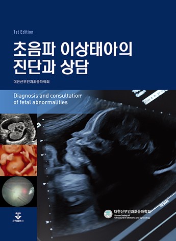 초음파 이상태아의 진단과상담