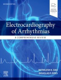 Electrocardiography of Arrhythmias-A Comprehensive Review-2판