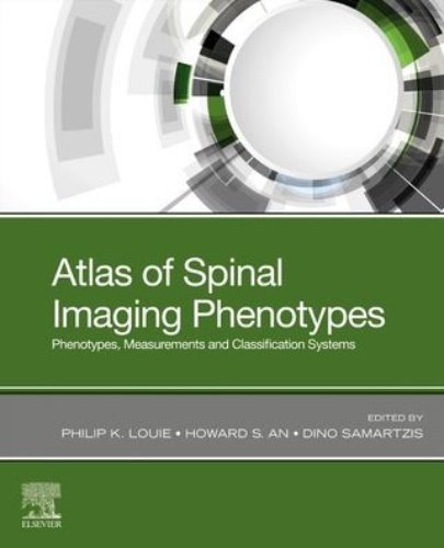 Atlas of Spinal Imaging-1판