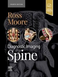 Diagnostic Imaging: Spine-4판
