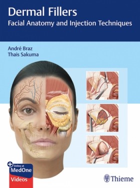 Dermal Fillers: Facial Anatomy and Injection Techniques-1판