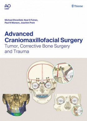 Advanced Craniomaxillofacial Surgery: Tumor Corrective Bone Surgery and Trauma