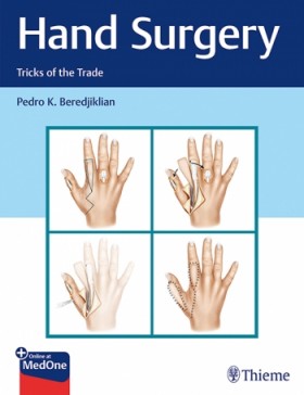 Hand Surgery-1판