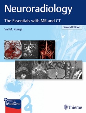 Neuroradiology The Essentials with MR and CT-2판