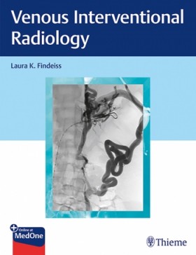 Venous Interventional Radiology-1판