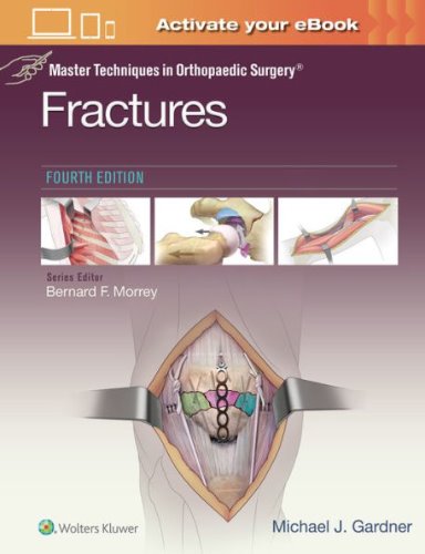 Master Techniques in Orthopaedic Surgery: Fractures-4판