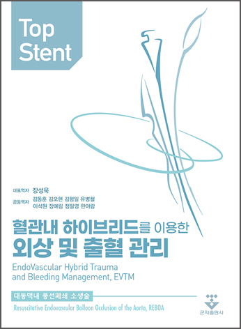 Top Stent