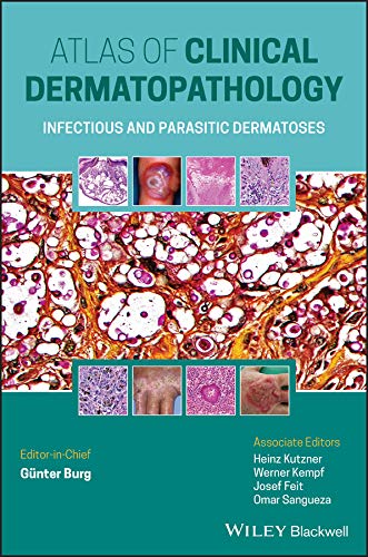 Atlas Of Clinical Dermatopathology - Infectious And Parasitic Dermatoses-1판