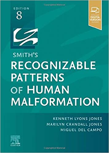 Smith's Recognizable Patterns of Human Malformation-8판