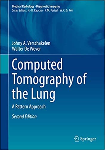 Computed Tomography of the Lung-2판