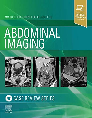 Abdominal Imaging, Case Review Series-1판
