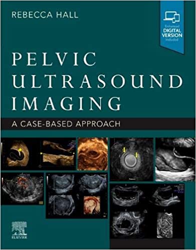 Pelvic Ultrasound Imaging-1판