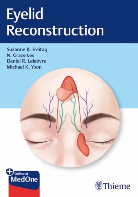 Eyelid Reconstruction