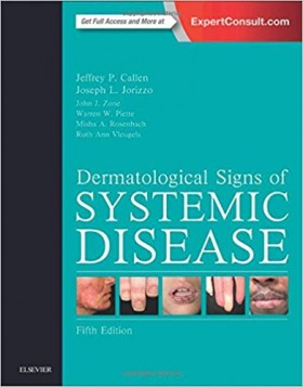 Dermatological Signs of Systemic Disease-5판