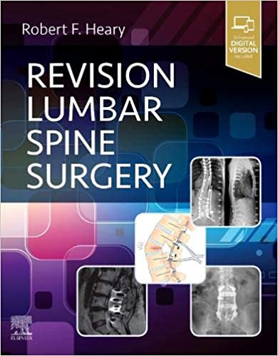 Revision Lumbar Spine Surgery-1판