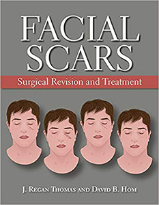 Facial Scars: Surgical Revision and Treatment