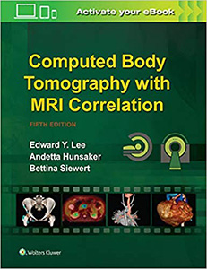 Computed Body Tomography with MRI Correlation-5판