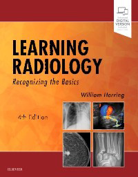 Learning Radiology-4판