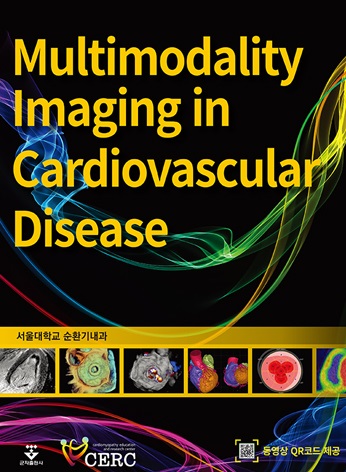 Multimodality Imaging in Cardiovascular Diseas