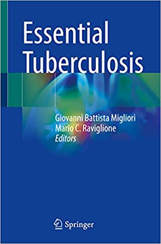 Essential Tuberculosis-1판