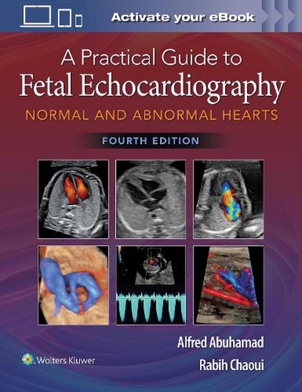 A Practical Guide to Fetal Echocardiography: Normal and Abnormal Hearts-4판