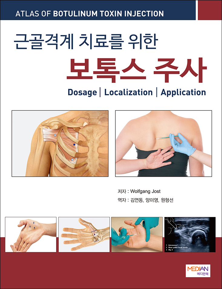 근골격계 치료를 위한 보톡스 주사
