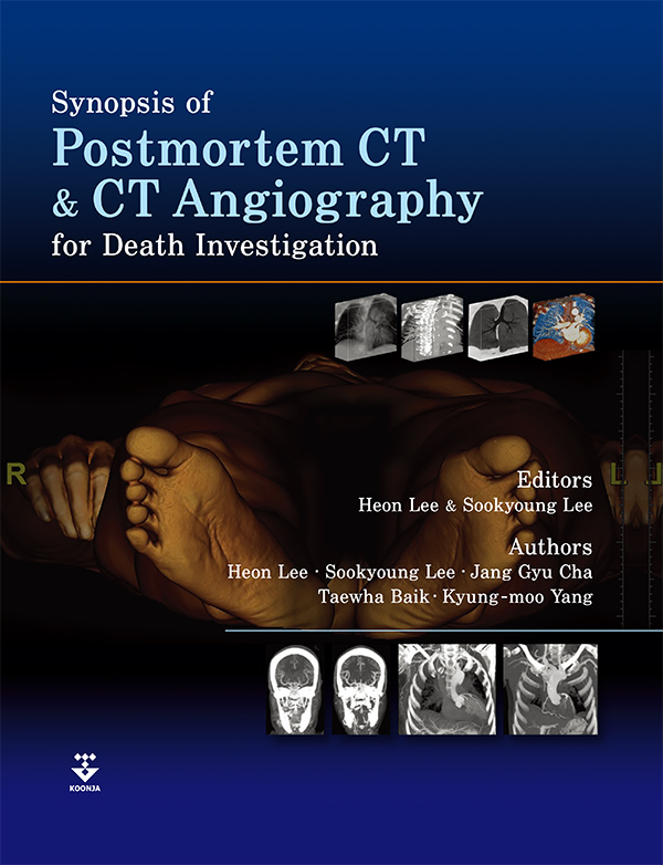 Synopsis of Postmortem CT and CT Angiography for Death Investigation