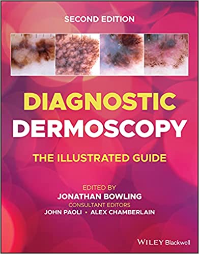 Diagnostic Dermoscopy: The Illustrated Guide - 2