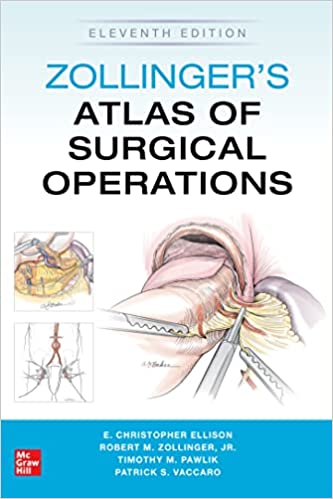 Zollinger's Atlas of Surgical Operations-11판(IE)