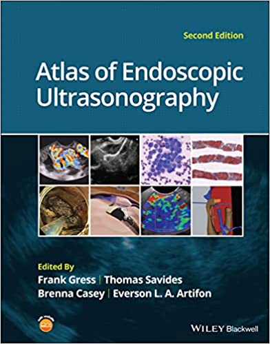 Atlas of Endoscopic Ultrasonography-2판