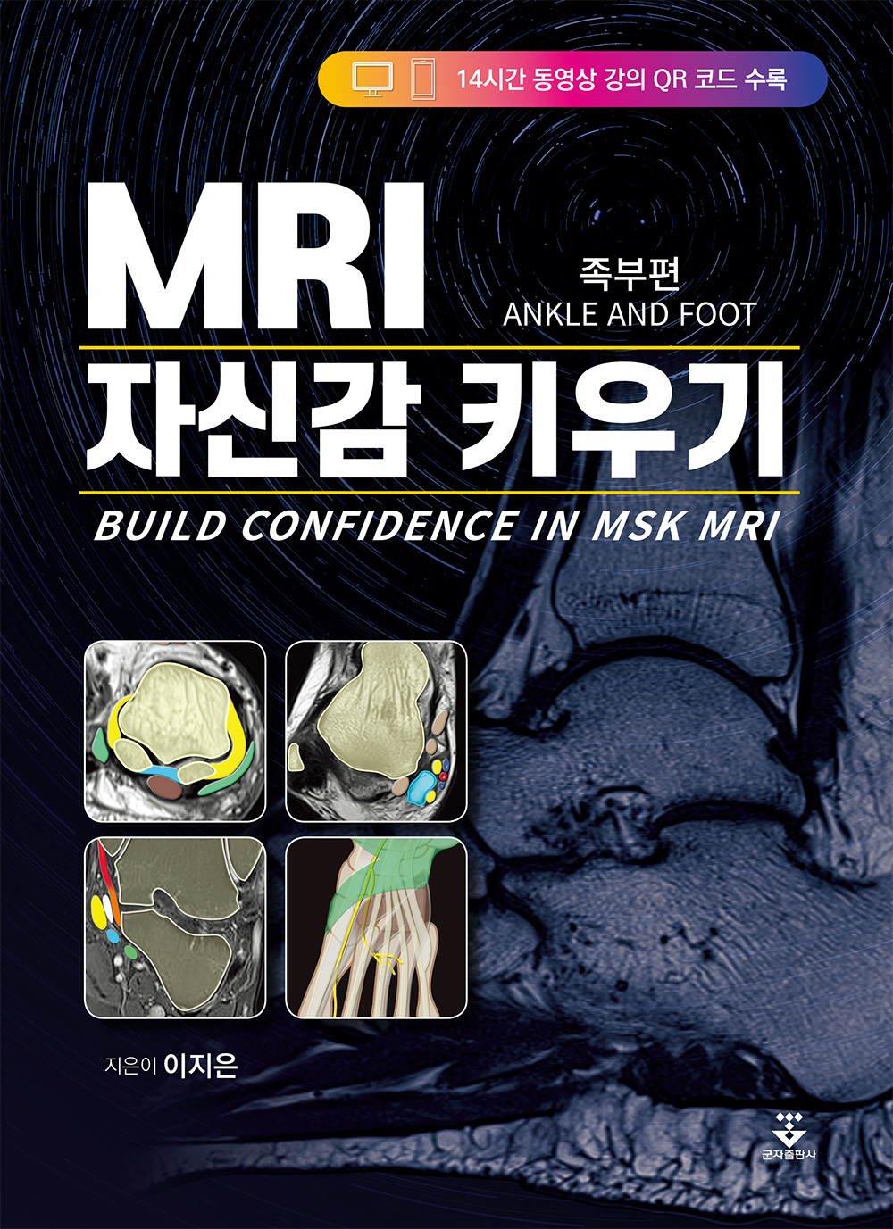 MRI 자신감 키우기-BUILD CONFIDENCE IN MSK MRI