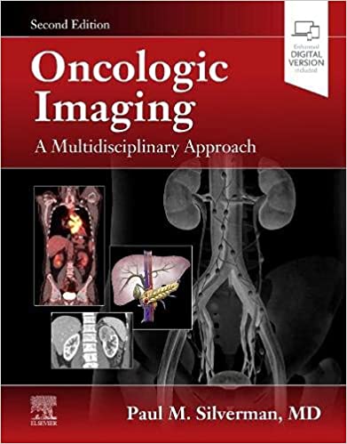 Oncologic Imaging-2판