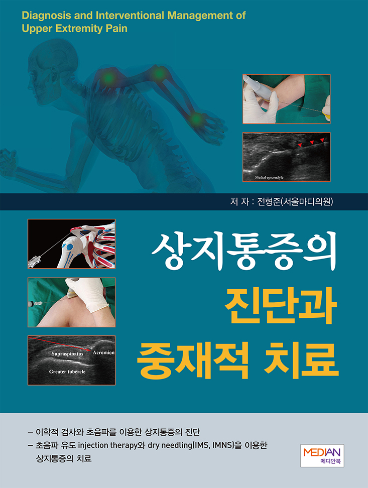 상지통증의 진단과 중재적 치료