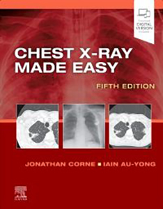 Chest X-Ray Made Easy-5판