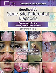 Goodheart's Same-Site Differential Diagnosis: Dermatology for the Primary Health Care Provider-2판