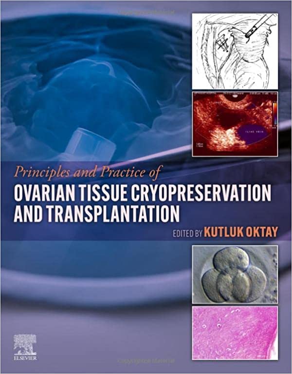 Ovarian Tissue Cryopreservation and Transplantation-1판