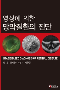 영상에 의한 망막질환의 진단