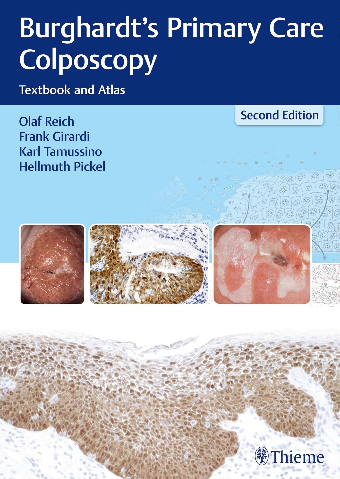 Burghardt`s Primary Care Colposcopy-2판
