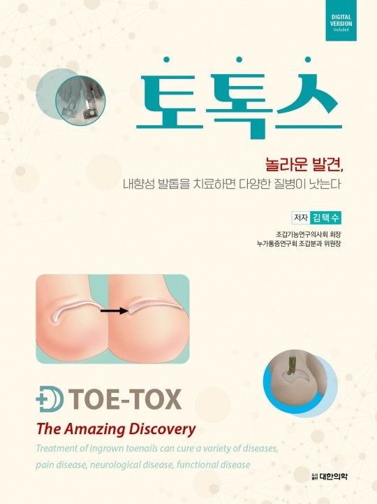 토톡스