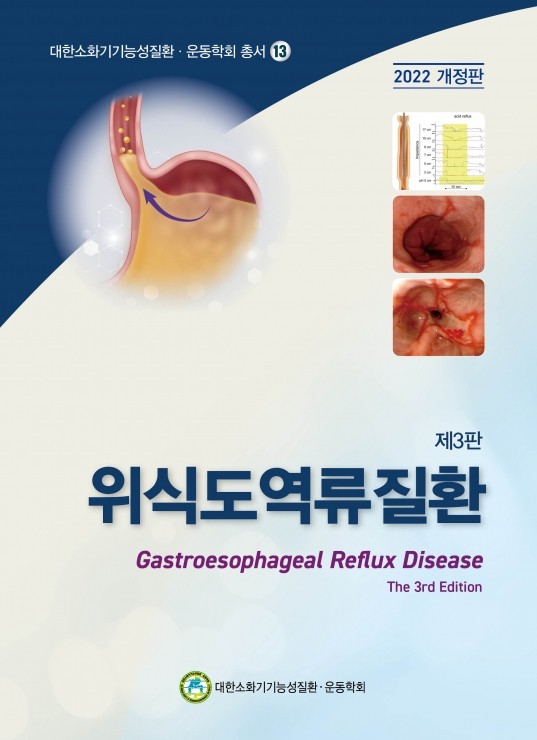 위식도역류질환-3판