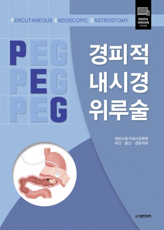 경피적 내시경 위루술
