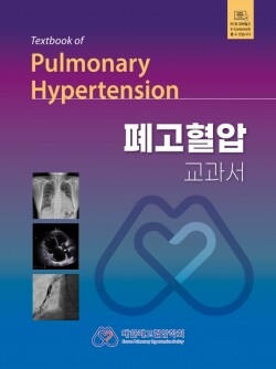 폐고혈압교과서-1판