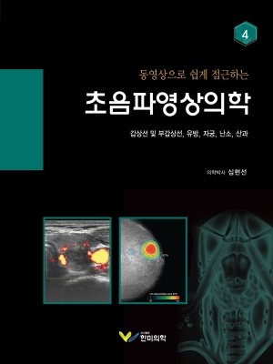 동영상으로 쉽게 접근하는 초음파영상의학-4번