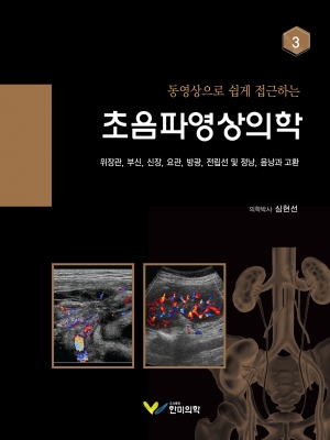 동영상으로 쉽게 접근하는 초음파영상의학-3번