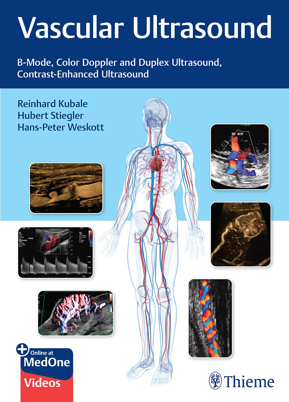 Vascular Ultrasound -1판