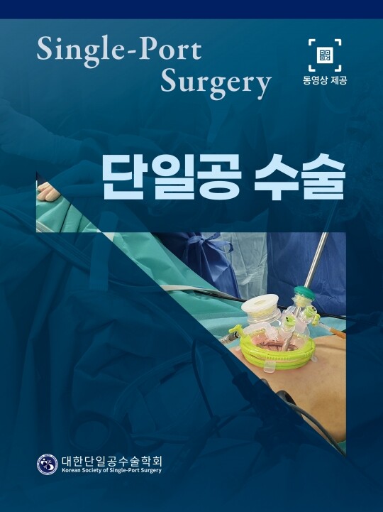 단일공 수술