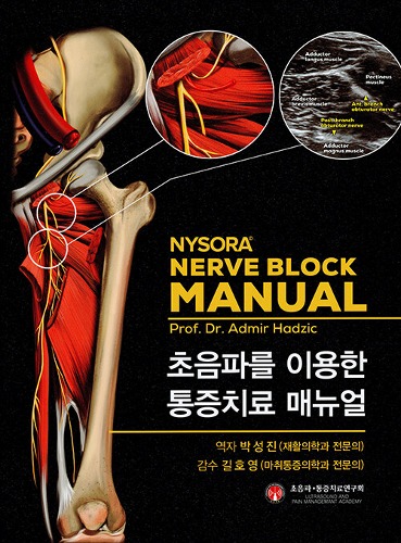 초음파를 이용한 통증치료매뉴얼