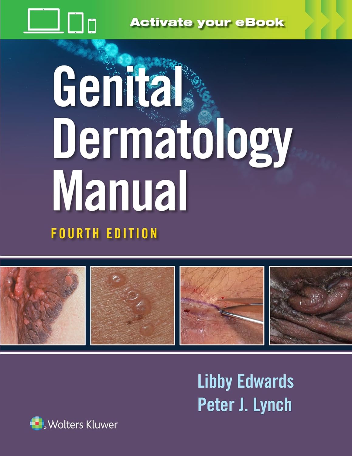 Genital Dermatology Manual-4판